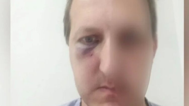    Xalq artistinin oğlunu döyməyə görə daha 2 şəxs saxlanıldı   