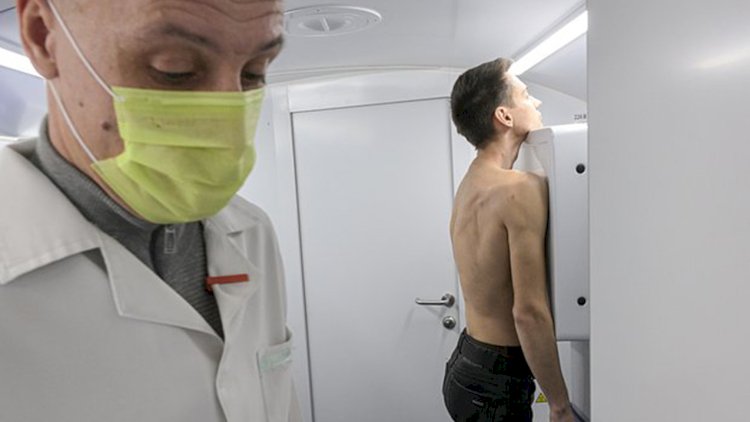    Rusiyada antibiotiklərə davamlı vərəm ştammı aşkar edildi   