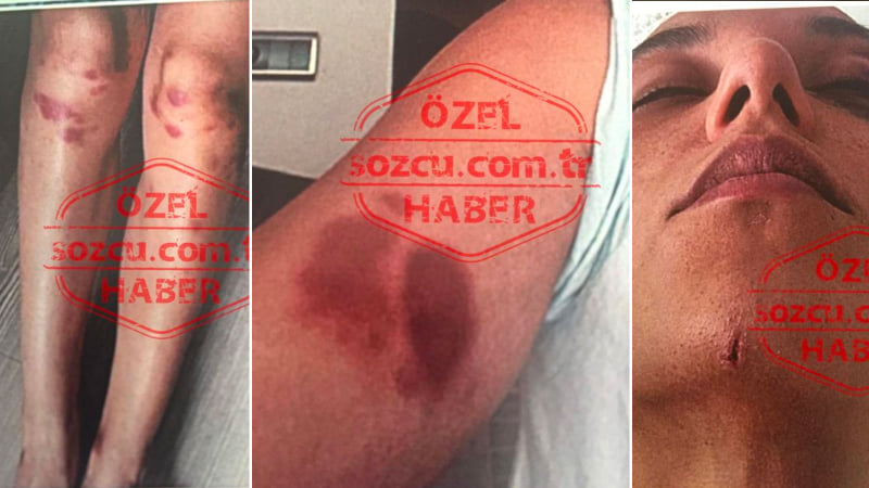 Özündən 17 yaş kiçik sevgilisini döyən aktyor hakim qarşısında - Fotolar Özündən 17 yaş kiçik sevgilisini döyən aktyor hakim qarşısında - Fotolar