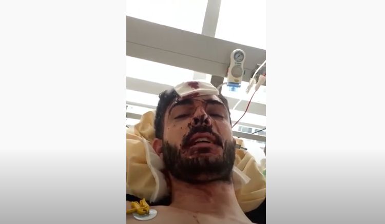 Məhəmməd Mirzəlinin əllərini, ağzını doğradılar - Foto Məhəmməd Mirzəlinin əllərini, ağzını doğradılar - Foto